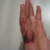 200809_hand_1
