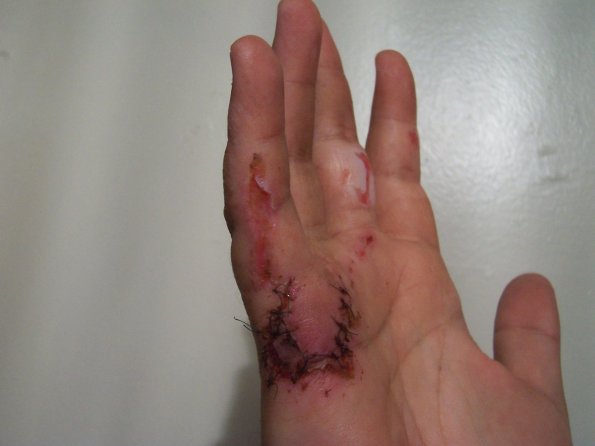 200809_hand_1