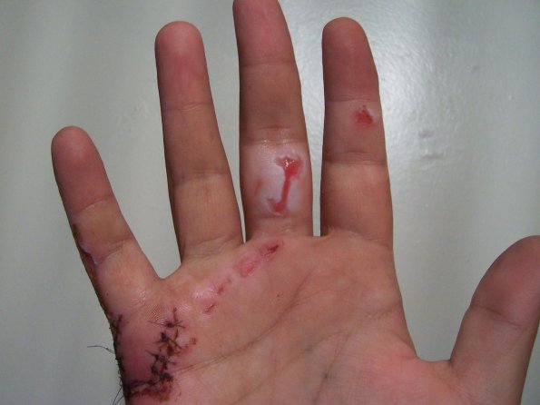 200809_hand_2