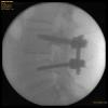 Screws_sideview