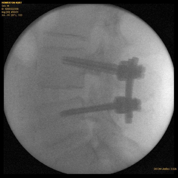 Screws_sideview
